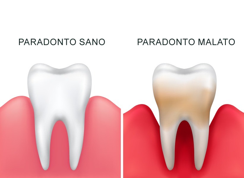 Parodontologia